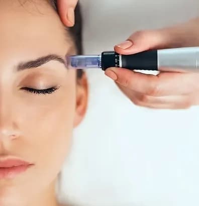 Microneedling