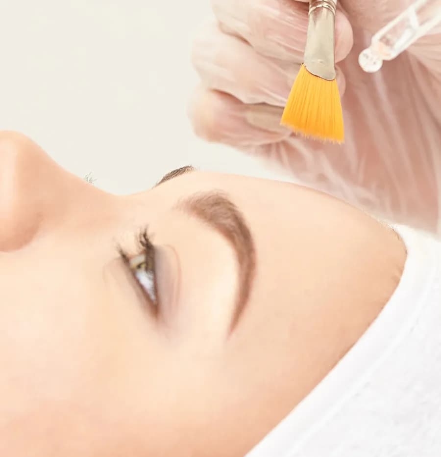 Peeling Professionnel